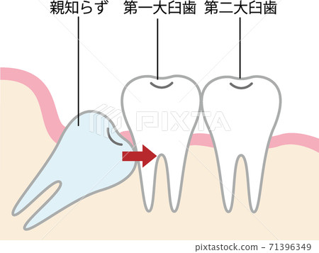 陌生的插圖壓在後牙上 陌生的插圖壓在後牙上 71396349