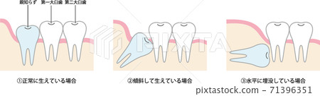 陌生的類型圖 陌生的類型圖 71396351