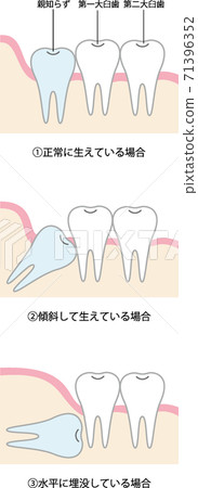 陌生的類型圖 陌生的類型圖 71396352