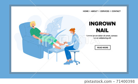 Ingrown Nail Medical Treatment Procedure Vector Illustration Ingrown Nail Medical Treatment Procedure Vector Illustration 71400398
