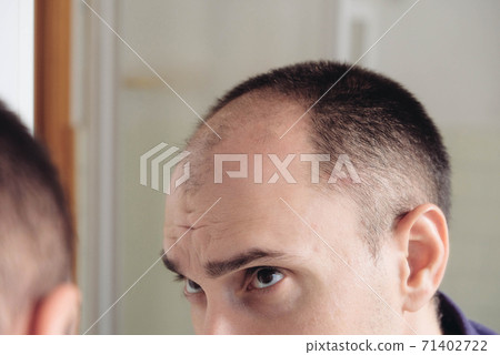 Young man looking at mirror worry about balding. Young man looking at mirror worry about balding. 71402722