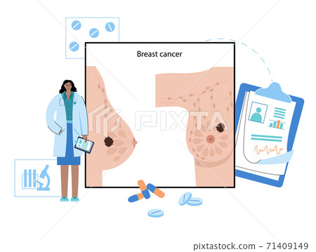 Breast disease concept 71409149