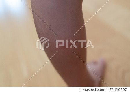 昆蟲被小牛咬傷 昆蟲被小牛咬傷 71410507