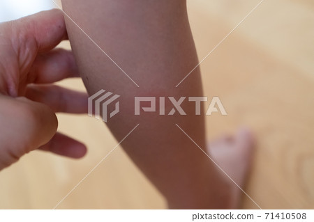 昆蟲被小牛咬傷 71410508