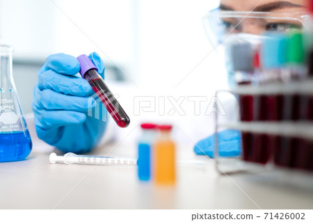 Professional doctors perform find virus tests from samples of blood tests to diagnose coronary virus infections analysis and sampling of infectious Professional doctors perform find virus tests from samples of blood tests to diagnose coronary virus infections analysis and sampling of infectious 71426002