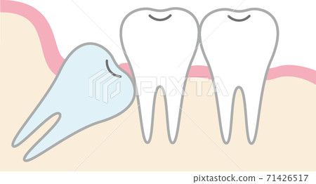 陌生的插圖 71426517