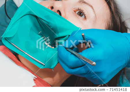 Dental restoration and polymerization of tooth composite materials, the doctor conducts sterile work on tooth restoration. Dental restoration and polymerization of tooth composite materials, the doctor conducts sterile work on tooth restoration. 71451418