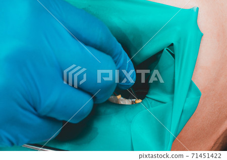 The dentist treats the patient's tooth with a rubber dam, drill, mirror. The dentist treats the patient's tooth with a rubber dam, drill, mirror. 71451422
