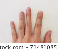 Deep finger 71481085