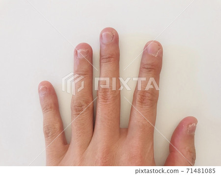 Deep finger 71481085