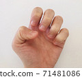 Deep nail hands 71481086
