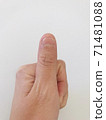 Deep thumb 71481088