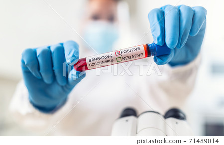 A positive coronavirus test held in hands by a laboratory staff A positive coronavirus test held in hands by a laboratory staff 71489014