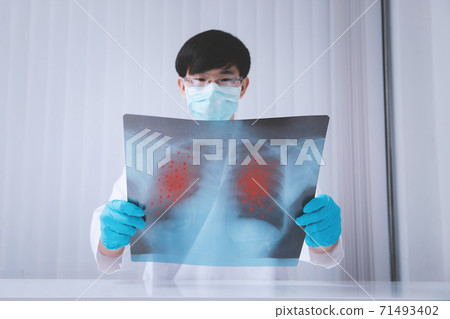 A doctor is diagnosing the results of the lung X-rays of patients infected with the coronavirus. The film shows symptom of corona virus infect patient lung and respiratory organ. A doctor is diagnosing the results of the lung X-rays of patients infected with the coronavirus. The film shows symptom of corona virus infect patient lung and respiratory organ. 71493402