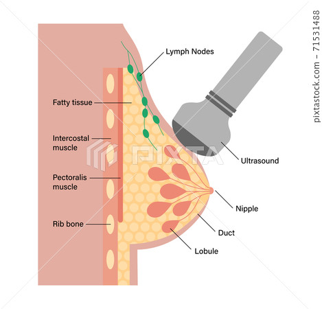 Breast disease concept Breast disease concept 71531488