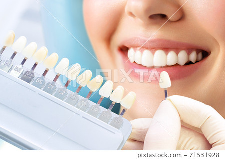 Smiling young woman. Cosmetological teeth whitening in a dental clinic. selection of the tone of the implant tooth 71531928