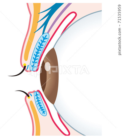 眼瞼結構小麥肉芽腫截面 71535959