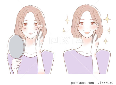 Before and after of middle-aged women who care about age spots Before and after of middle-aged women who care about age spots 71536030