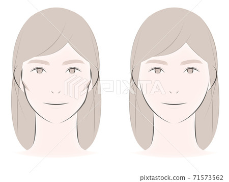 比較有和沒有che骨的女性 插圖素材 圖庫