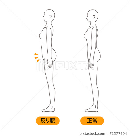 Female medical posture (warped waist) beauty... - Stock Illustration