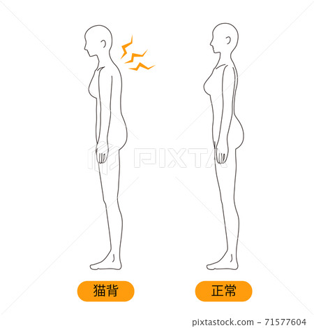 Female medical posture (stoop) beauty naked... - Stock Illustration
