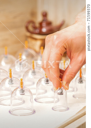 Masseur takes vacuum massage jars Masseur takes vacuum massage jars 71599370