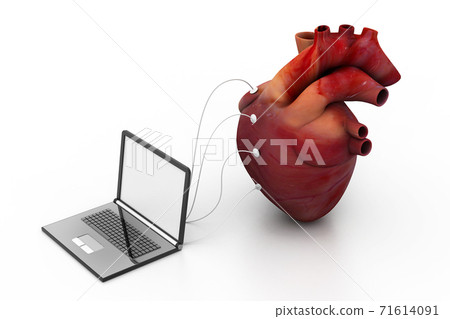 computer connected to a human heart. 71614091
