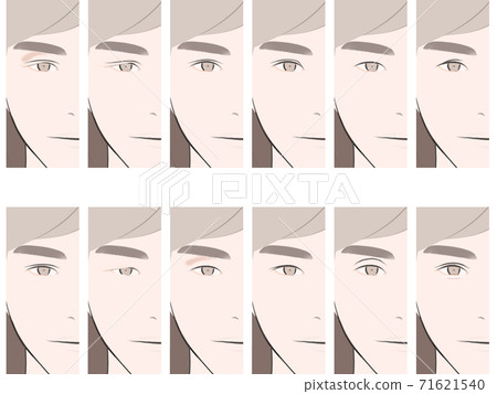 Eyelid comparison male 71621540
