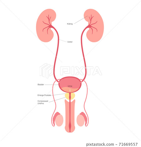 BPH info concept BPH info concept 71669557