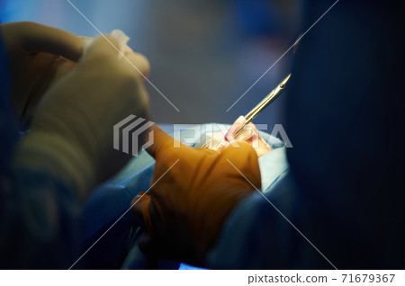 Surgery. Close-up of a surgeon's hand with a clamp. Bleeding. 71679367