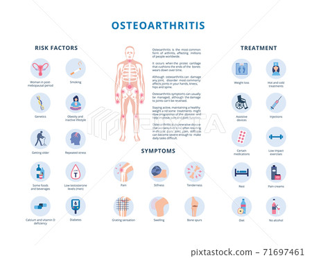 Osteoarthritis risk factors and treatment flat vector illustration isolated. 71697461