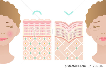 Wrinkle cross section female - Stock Illustration [71726102] - PIXTA