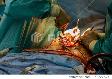 Surgeon doctor close up hands of open heart of surgeons 71727874