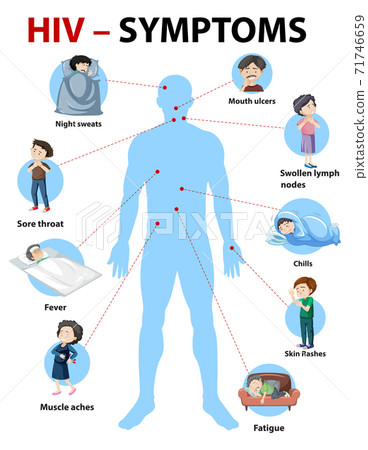 Symptoms of HIV infection infographic 71746659