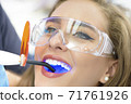 Dentist Using Ultraviolet Lamp 71761926