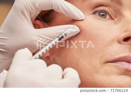 Anti aging cosmetology. Close up of a caucasian mature woman getting cosmetic injection in her cheek Anti aging cosmetology. Close up of a caucasian mature woman getting cosmetic injection in her cheek 71766224