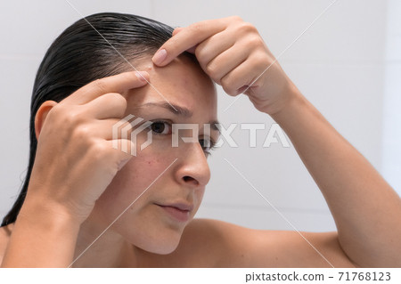 Close-up portrait of a girl squeezes out a pimple on her forehead. An awkward moment before a date 71768123