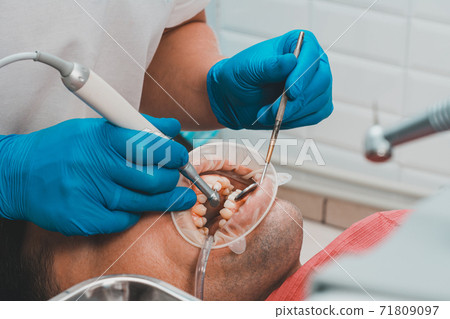 patient removing tartar,the dentist uses ultrasound to remove tartar,dental scaler. 71809097