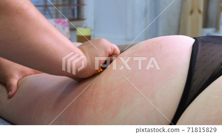 The masseur makes an anti-cellulite massage by massaging thick female legs. Beauty treatment concept 71815829