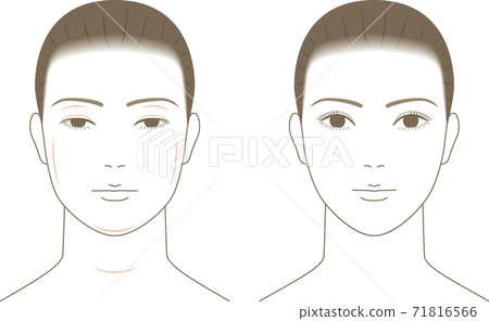 Swollen female face 71816566