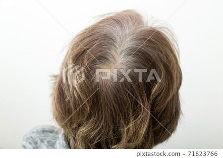 高級頭髮護髮白髮 高級頭髮護髮白髮 71823766
