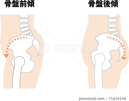 Pelvic forward / backward tilt 71824148