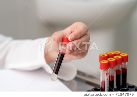 Test tube with blood in hand. 71847079