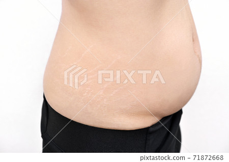 Pregnancy line Pregnancy line 71872668