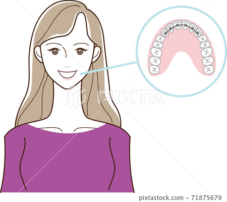 Orthodontics and female illustrations Orthodontics and female illustrations 71875679