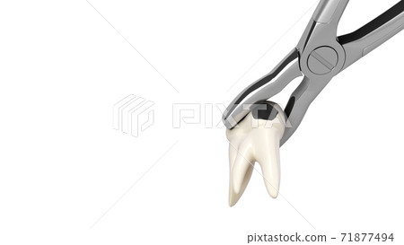 tooth clamped in medical extraction forceps dental services concept 3d render on white 71877494