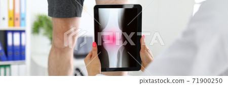 Traumatologist is holding tablet near patient's sore leg in the clinic closeup. 71900250