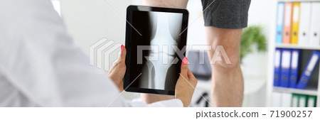Traumatologist is holding tablet near patient's sore leg in the clinic closeup. 71900257