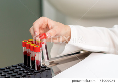 Blood sample tubes in hands. 71909924