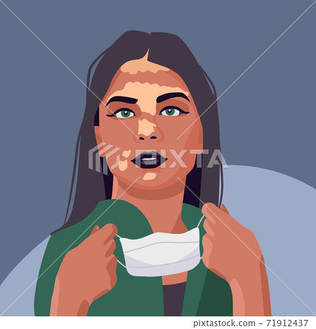 Vitiligo woman with mask on grey backdrop Vitiligo woman with mask on grey backdrop 71912437